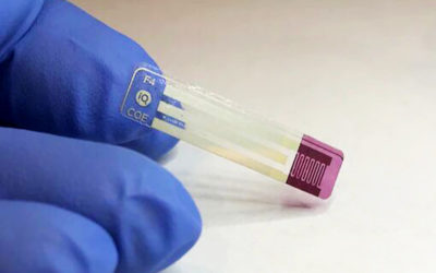 The world’s first needle-free diabetes test